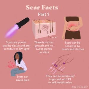 Scar Facts PT1