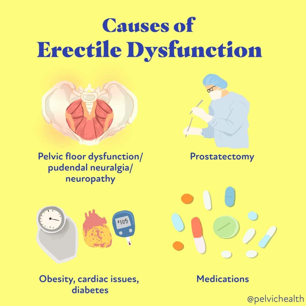 Understanding Erectile Dysfunction Treatment: A Comprehensive Overview