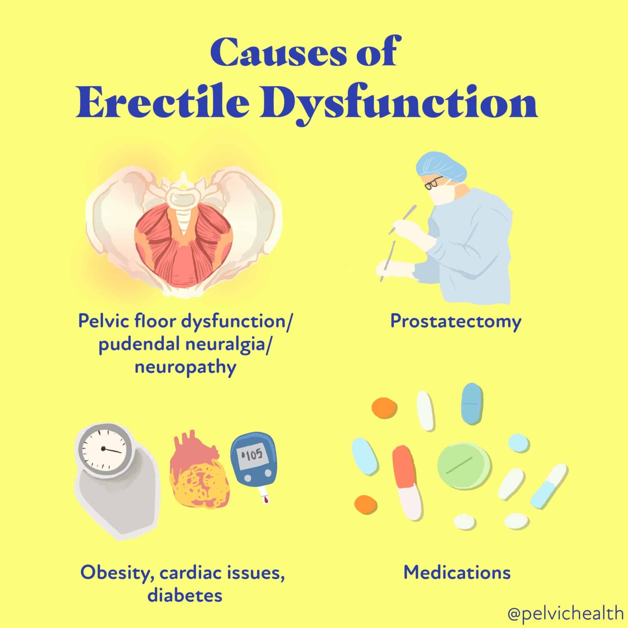 Male Pelvic Health Erectile Dysfunction Causes & Treatments