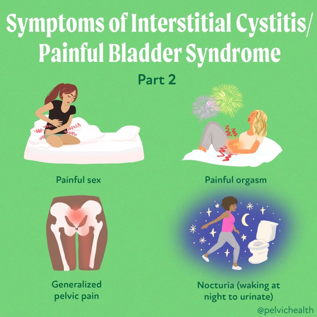 Symptoms of IC Pt 2 (1)