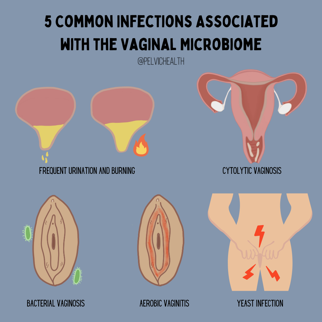 Paediatric vagina 