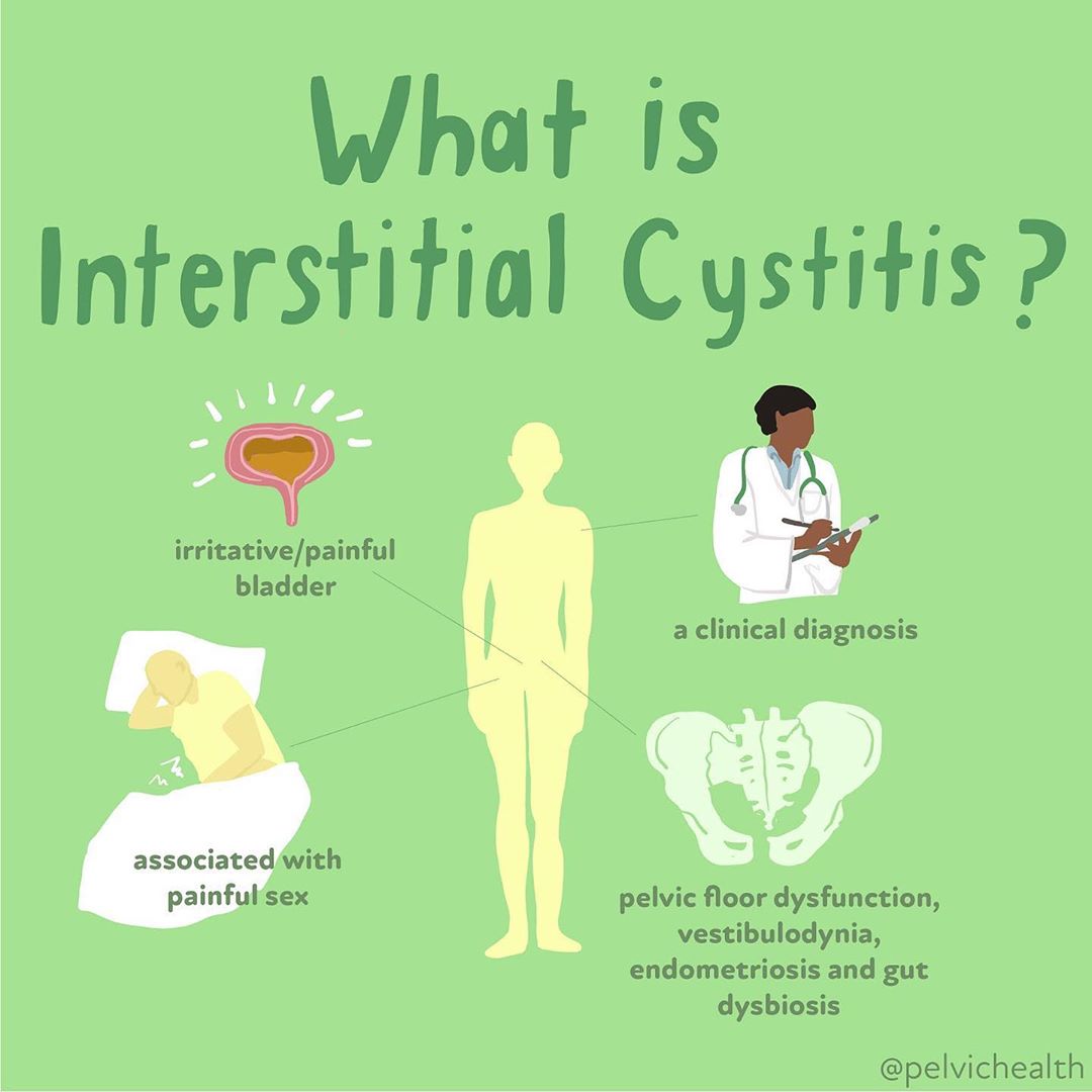 bpc 157 interstitial cystitis Interstitial Cystitis/Bladder Pain Syndrome: Diagnosis and Subtypes