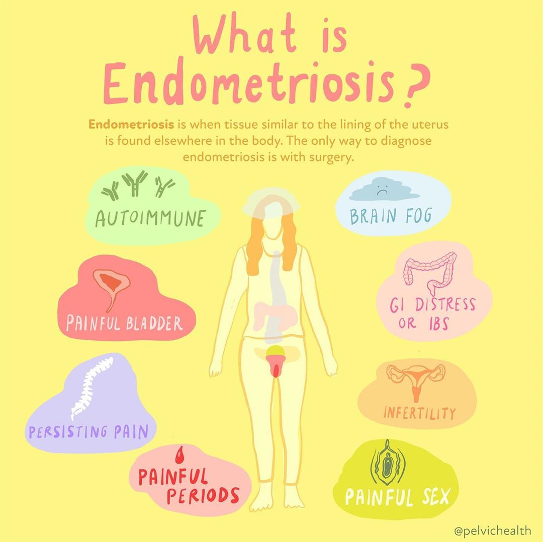 How First-Line Therapies for Endometriosis Impacts Your Pelvic Health