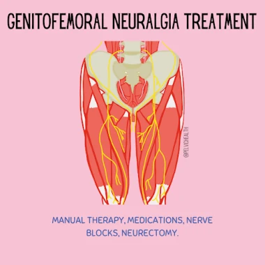 Genitofemofral neuralgia treatment