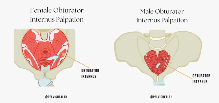 female obturator internus palpation