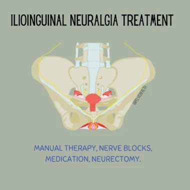 ilioinguinal neuralgia treatment