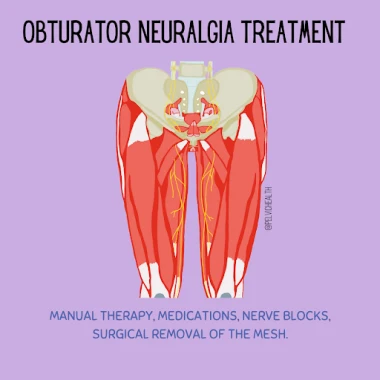 obturator neuragia treatment