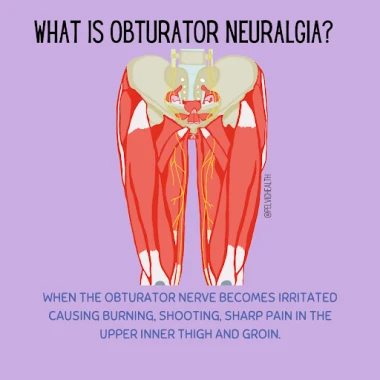 obturator neuragia