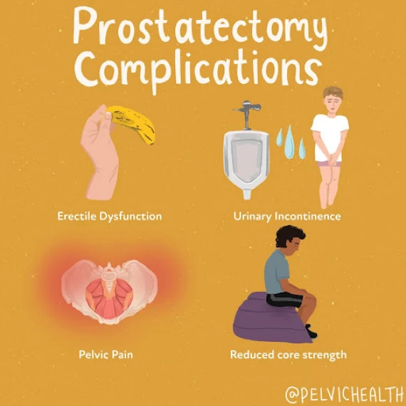 prostatectomy complications