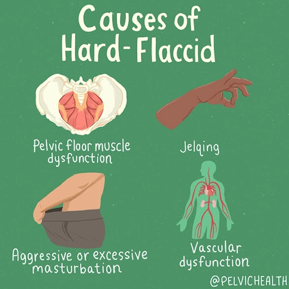  Causes of hard flaccid