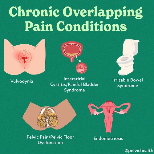 Chronic Overlapping
