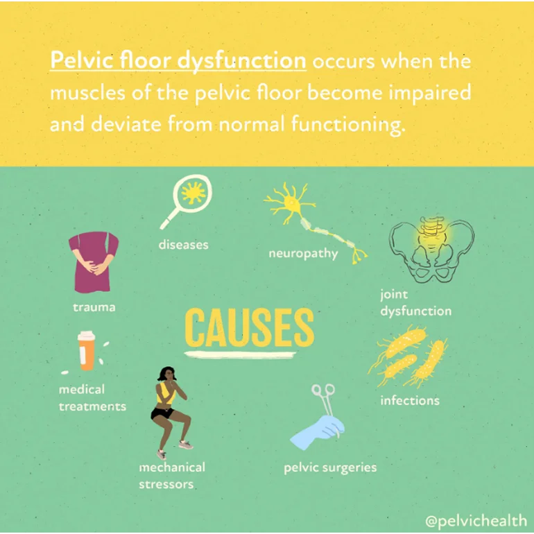What is Pelvic Floor Physical Therapy