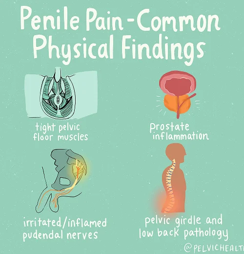 Penil Pain - Common Physical Finings Penil Pain - Common Physical Finings