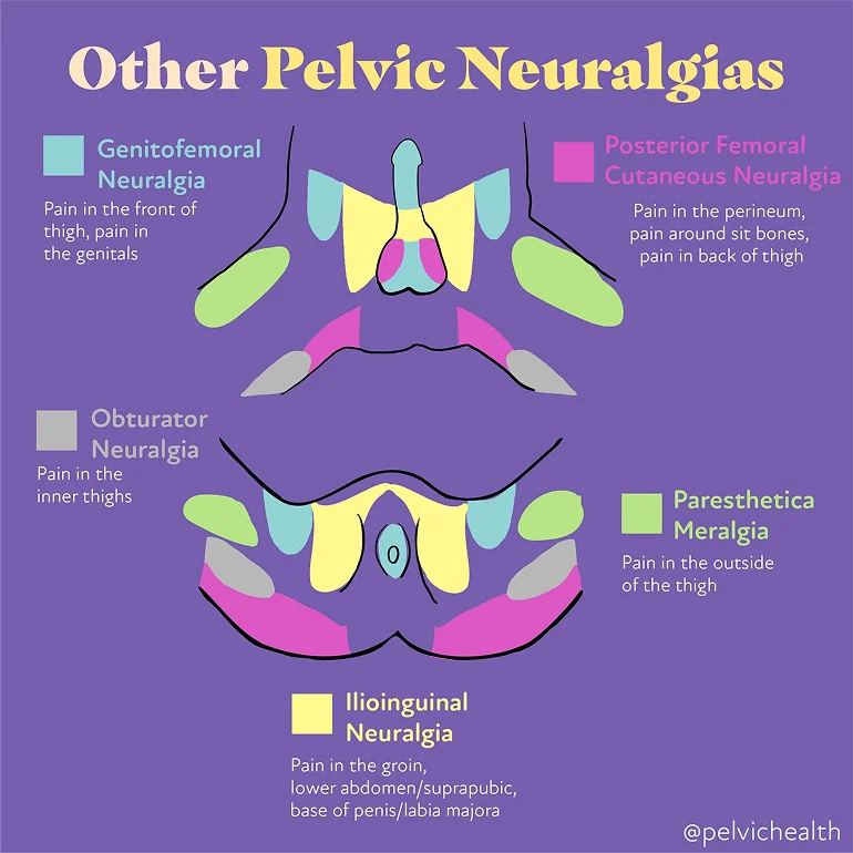 other-pelvic-neuralgias