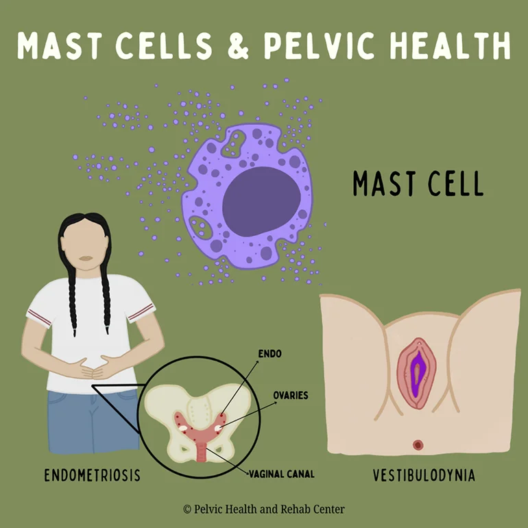Mast Cell and Pelvic Health